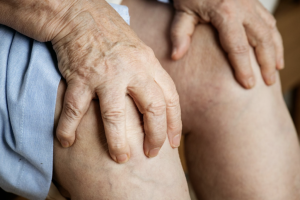 Brickell Rheumatology: Trusted Care for Gout and Autoimmune Diseases in Miami